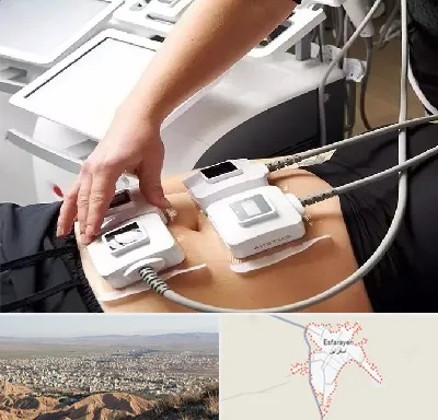 ترواسکالپ در اسفراین