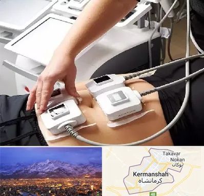 ترواسکالپ در کرمانشاه