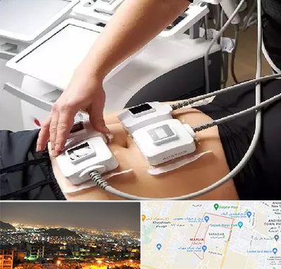 ترواسکالپ در مارلیک کرج