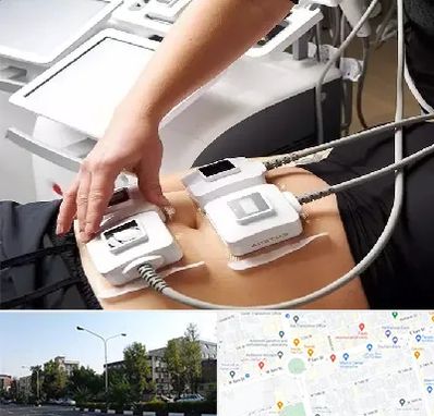 ترواسکالپ در میدان کاج 