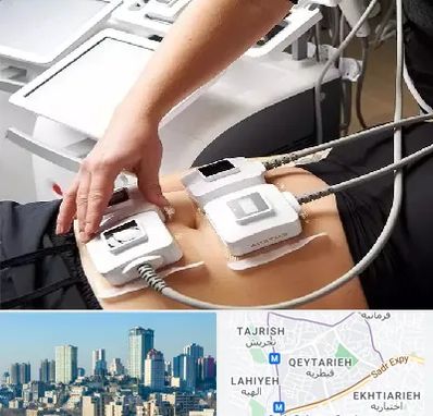 ترواسکالپ در قیطریه 