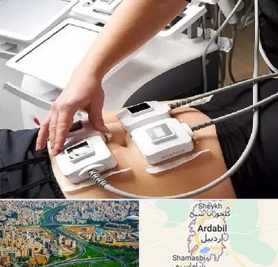 ترواسکالپ در اردبیل