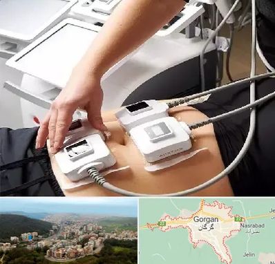 ترواسکالپ در گرگان