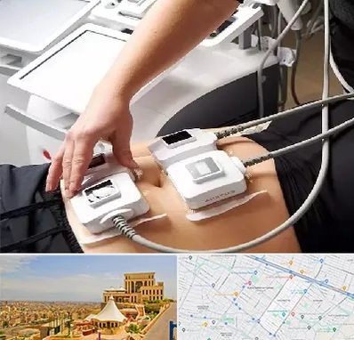 ترواسکالپ در هاشمیه مشهد