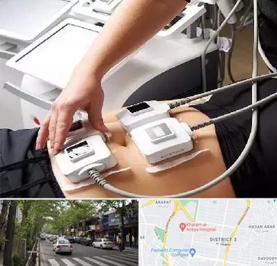 ترواسکالپ در ظفر 