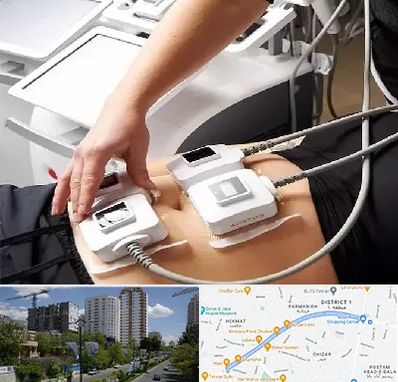 ترواسکالپ در اندرزگو