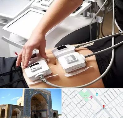 ترواسکالپ در مصلی مشهد