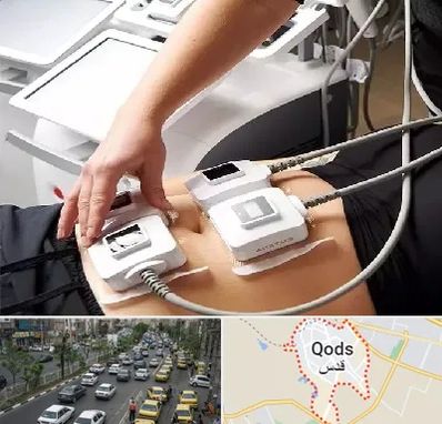 ترواسکالپ در شهر قدس