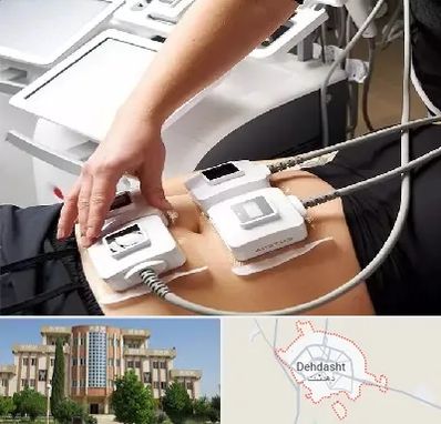 ترواسکالپ در دهدشت