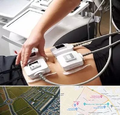 ترواسکالپ در الهیه مشهد