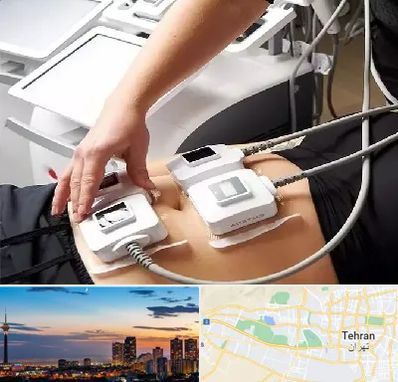 ترواسکالپ در غرب تهران 