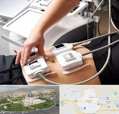 ترواسکالپ در بومهن