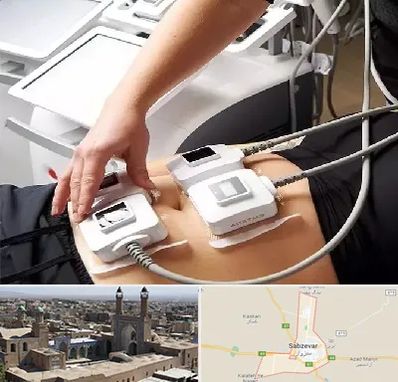 ترواسکالپ در سبزوار