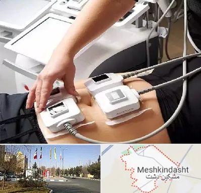 ترواسکالپ در مشکین دشت