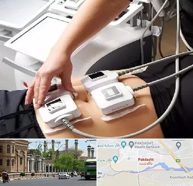 ترواسکالپ در پاکدشت