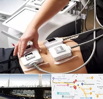 ترواسکالپ در پارک وی 