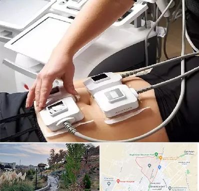 ترواسکالپ در باغستان کرج