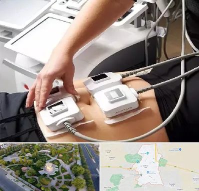 ترواسکالپ در کاشمر