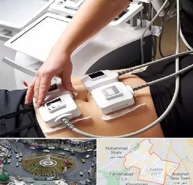 ترواسکالپ در فردیس کرج 