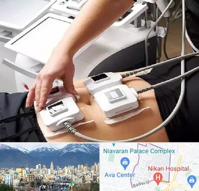 ترواسکالپ در آجودانیه 