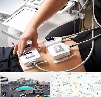 ترواسکالپ در میدان انقلاب 