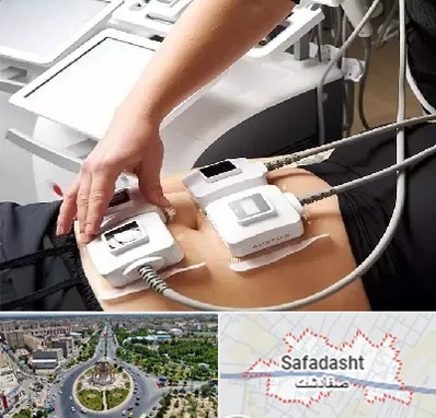 ترواسکالپ در صفادشت