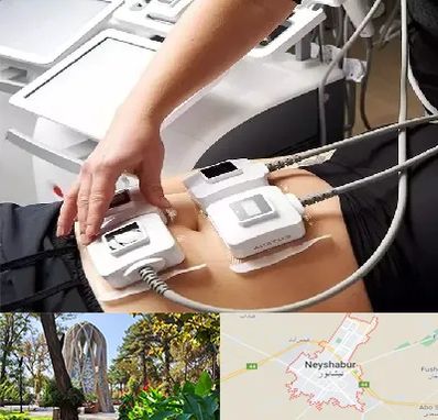 ترواسکالپ در نیشابور