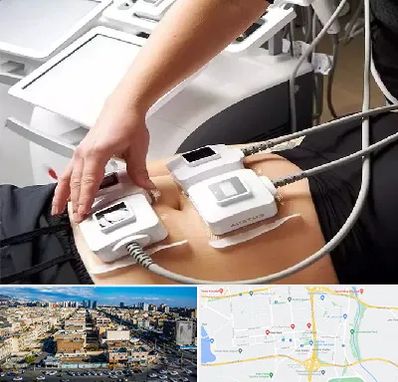 ترواسکالپ در شهرک راه آهن