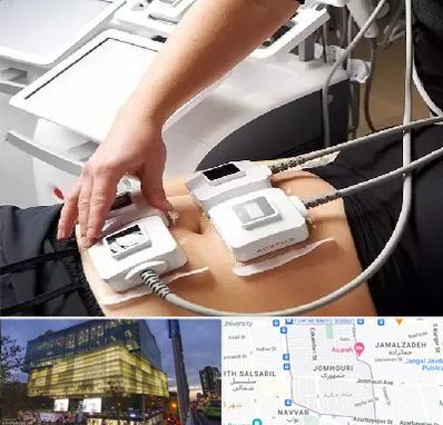 ترواسکالپ در جمهوری 