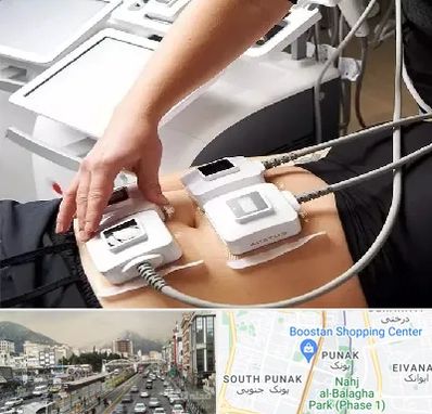 ترواسکالپ در پونک 