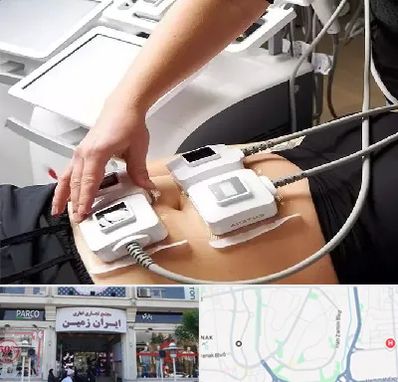 ترواسکالپ در ایران زمین