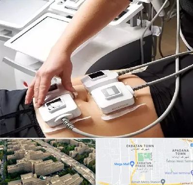 ترواسکالپ در اکباتان 