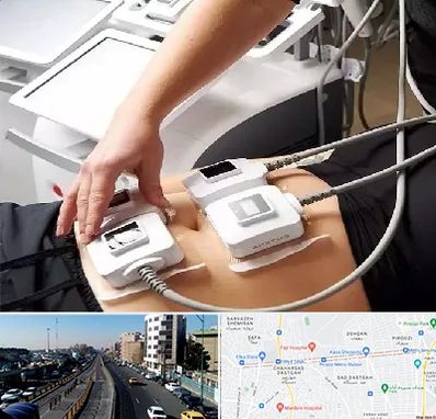 ترواسکالپ در پیروزی 