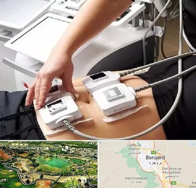 ترواسکالپ در بروجرد