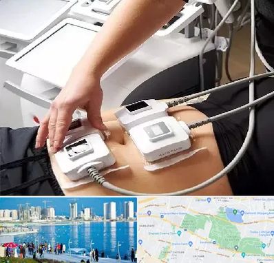 ترواسکالپ در چیتگر 