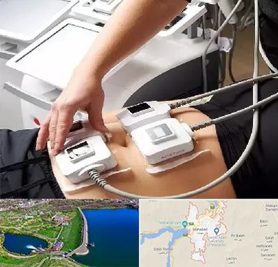 ترواسکالپ در مهاباد