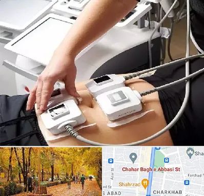 ترواسکالپ در چهارباغ اصفهان