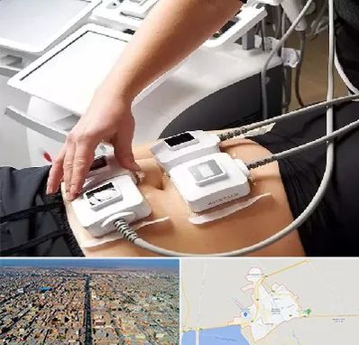 ترواسکالپ در بندر ماهشهر
