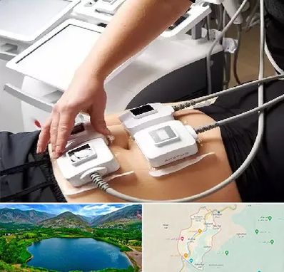 ترواسکالپ در رودبار