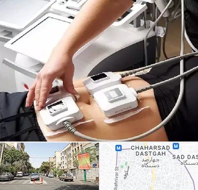 ترواسکالپ در چهارصد دستگاه 