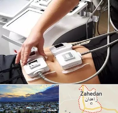 ترواسکالپ در زاهدان