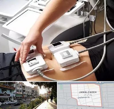 ترواسکالپ در خیابان جمالزاده