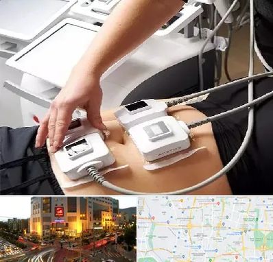 ترواسکالپ در جنت آباد تهران 