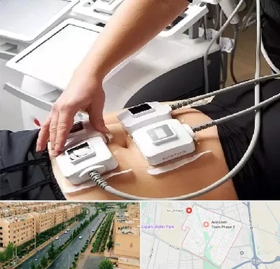 ترواسکالپ در فاز سه اندیشه