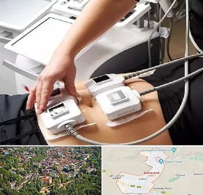 ترواسکالپ در دماوند