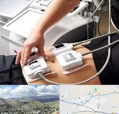 ترواسکالپ در رودهن