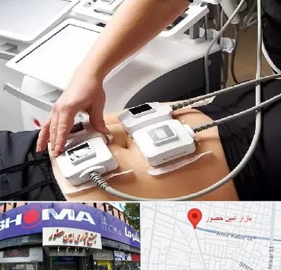 ترواسکالپ در امین حضور