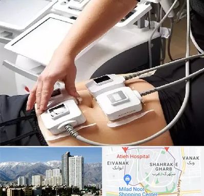 ترواسکالپ در شهرک غرب 