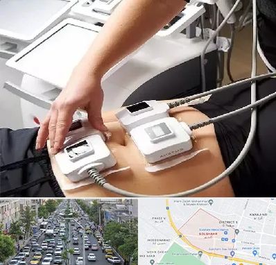 ترواسکالپ در گلشهر کرج