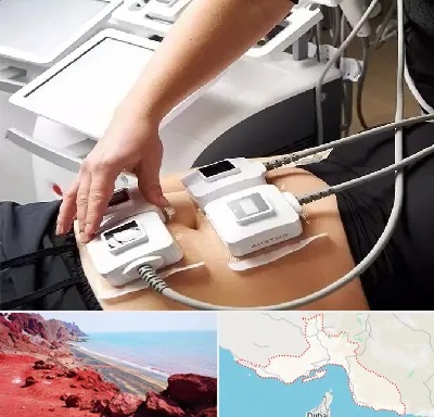 ترواسکالپ در هرمزگان